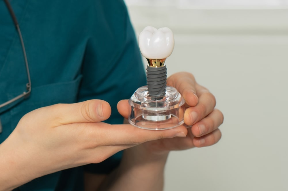 dental-bridges-and-crowns